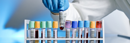 A hand in a blue glove places a labelled test tube into the middle of a line of other test-tubes, all with different coloured tops.