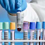 a row of test tubes in a lab with one being lifted out of the line-up