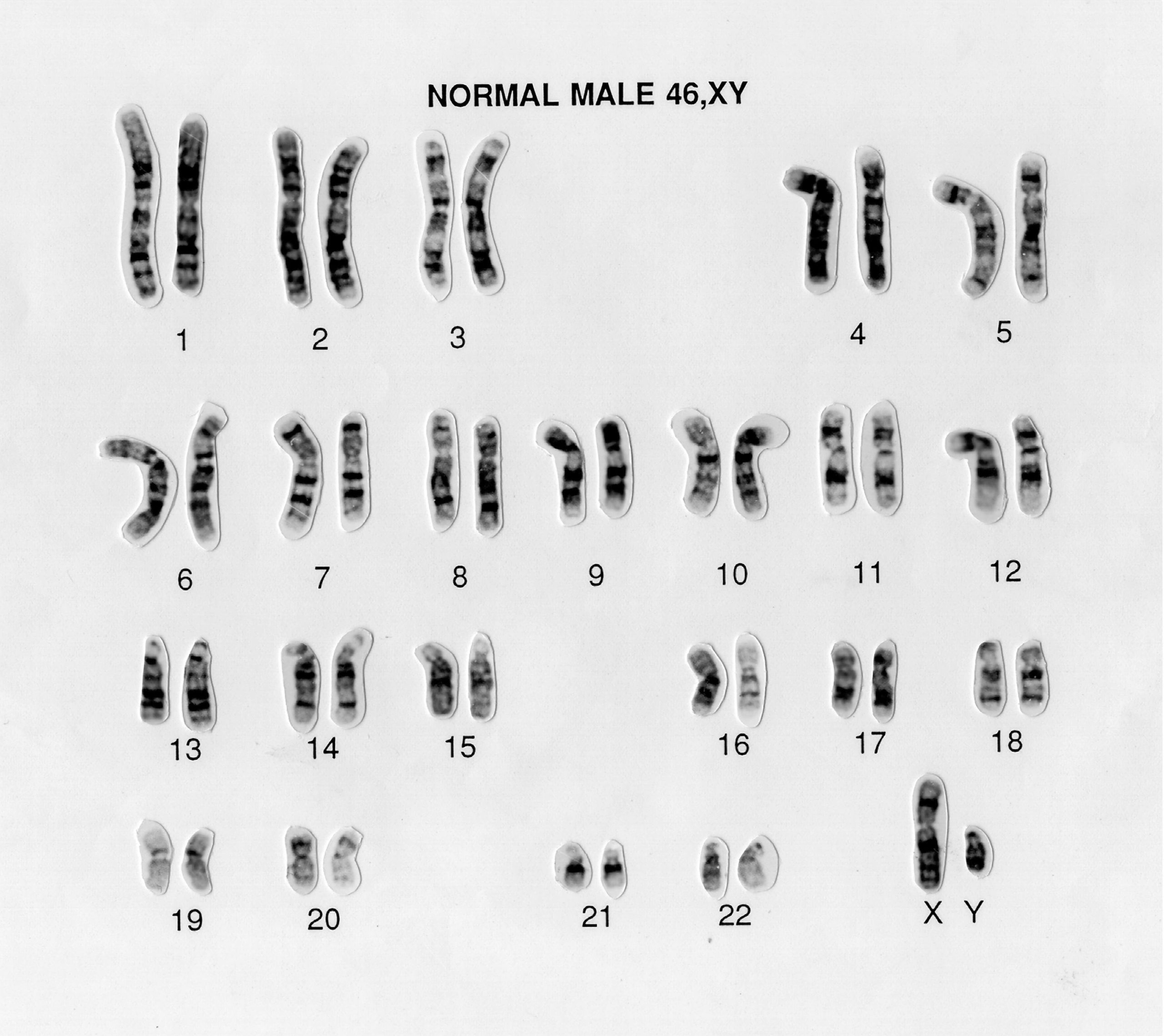 Male 46,XY human karyotype