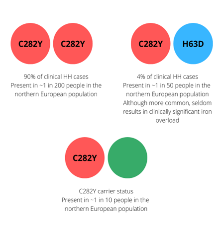 C282Y + C282Y = 90% of clinical cases. Present in approximately 1 in 200 people in the northern European population. C282Y + H63D = 4% of clinical HH cases. Present in approximately 1 in 50 people in the northern European population. Although more common, seldom results in clinically significant iron overload. C282Y + blank = C282Y carrier status. Present in approximately 1 in 10 people in the northern European population. 