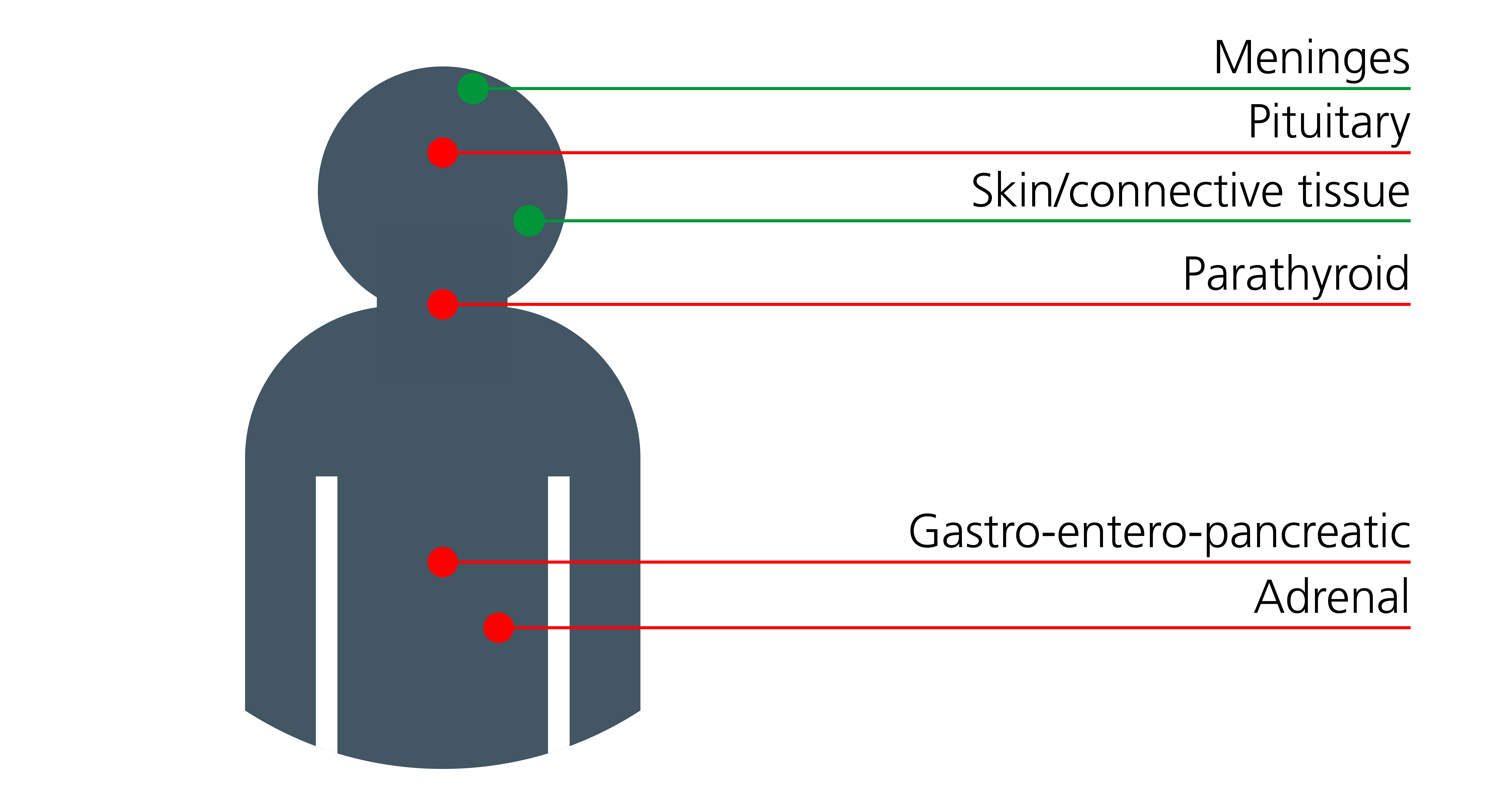 A basic human shape with red and green dots marking the place where tumours develop in MEN1 patients. The red dots mark pituitary, parathyroid, gastro-entero-pancreatic and adrenal tumours, and the green dots mark meninges and skin/connective tissue tumours.