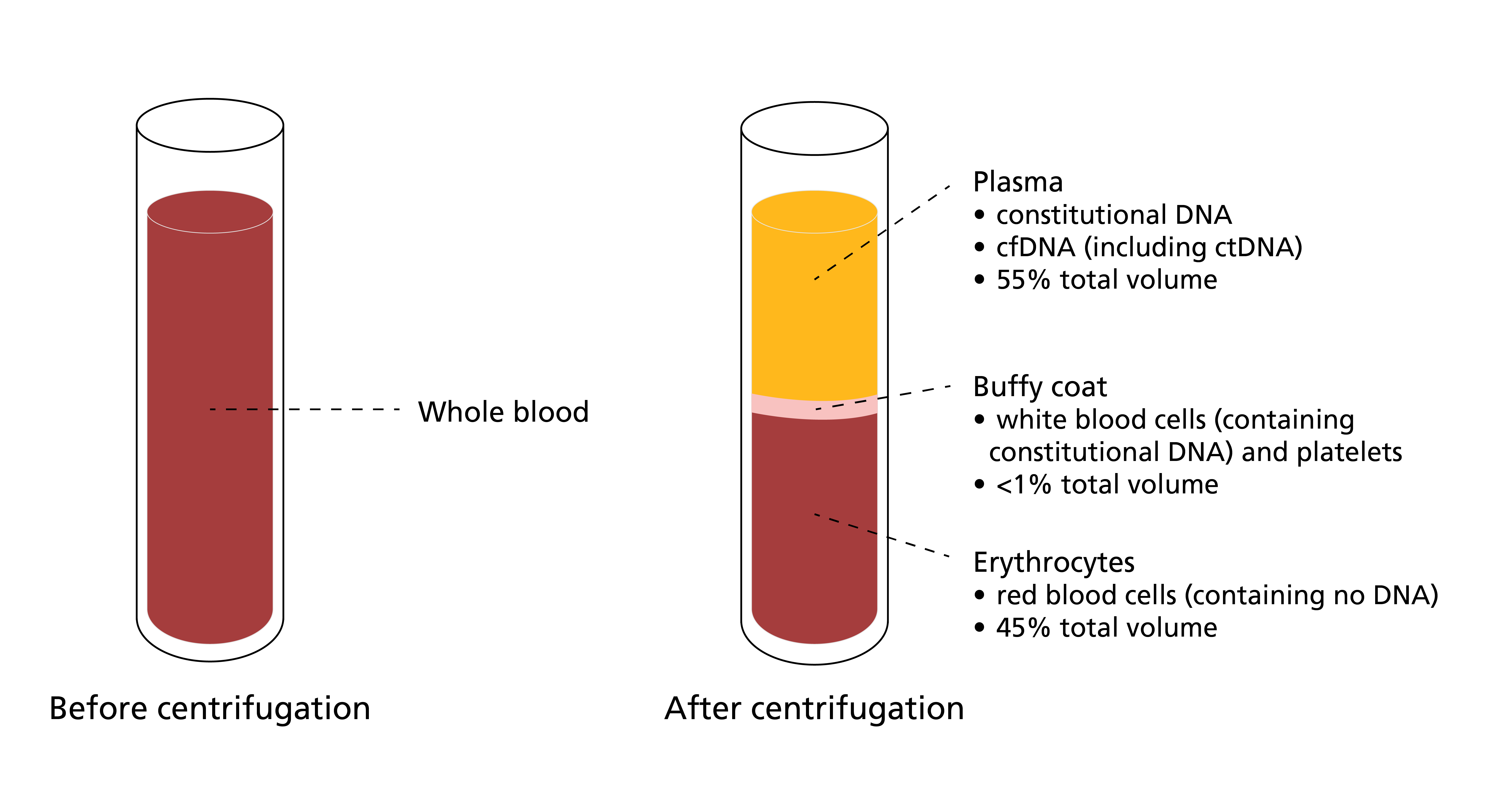 Centrifuging a blood sample separates it into three constituent parts: plasma, buffy coat and erythrocytes. Plasma contains both constitutional (germline) and somatic (tumour) DNA, while the buffy coat contains DNA derived from lymphocytes (including variants of constitutional origin and variants reflecting clonal haematopoiesis). The samples can be compared and analysed to identify which variants identified in the DNA that has been extracted from plasma are truly tumour-derived.