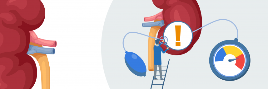 Illustration of a kidney and blood pressure monitor being investigated by a doctor.